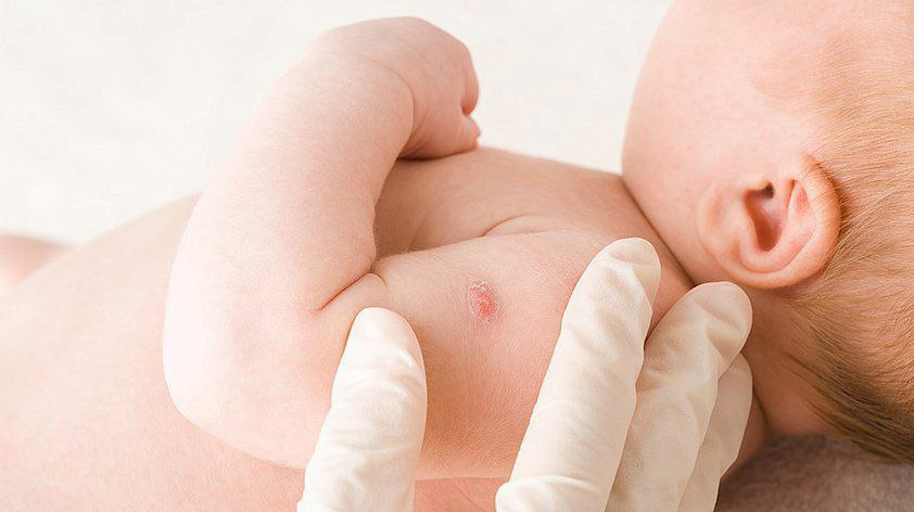 BSJ vaksinasi qanchalik muhim